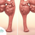 PCOS vs PCOD: Causes, Symptoms & How to Tell Them Apart
